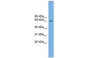 Image no. 1 for anti-Nuclear Receptor Subfamily 4, Group A, Member 3 (NR4A3) (AA 551-600) antibody (ABIN6744584) (NR4A3 Antikörper  (AA 551-600))