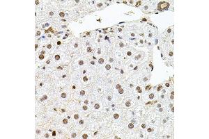 Immunohistochemistry of paraffin-embedded mouse liver using U2SURP antibody (ABIN6132839, ABIN6149759, ABIN6149760 and ABIN6220240) at dilution of 1:100 (40x lens). (SR140 Antikörper  (AA 705-1029))