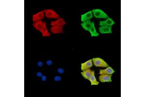 ABIN7096615 and ABIN7100679 staining HepG2 cells by IF/ICC. (ARMC9 Antikörper)