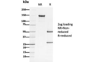 SDS-PAGE Analysis Purified APC Mouse Monoclonal Antibody (ALi 12-28). (APC Antikörper  (AA 1-433))