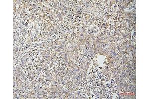 IHC analysis of Cofilin-2 using anti-Cofilin-2 antibody (ABIN7602747).