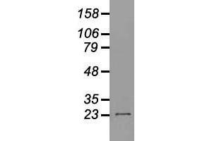 Western blot analysis of 35 µg of cell extracts from human (HeLa) cells using anti-NEUROG1 antibody. (Neurogenin 1 Antikörper)