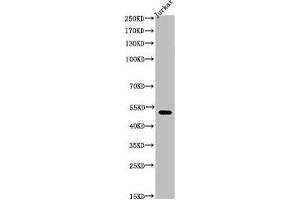 Western Blot analysis of Jurkat cells using Acetyl-Tubulin α (K40) Polyclonal Antibody (TUBA1A Antikörper  (acLys402))