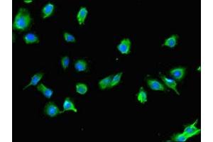 Immunofluorescent analysis of U251 cells using ABIN7175459 at dilution of 1:100 and Alexa Fluor 488-congugated AffiniPure Goat Anti-Rabbit IgG(H+L) (UBE2Z Antikörper  (AA 1-146))