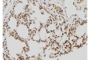 ABIN6277645 at 1/100 staining Rat lung tissue by IHC-P. (RNF2 Antikörper  (Internal Region))