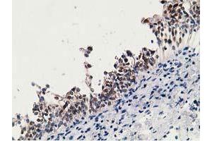 Image no. 2 for anti-Hydroxyprostaglandin Dehydrogenase 15-(NAD) (HPGD) antibody (ABIN1496361) (HPGD Antikörper)