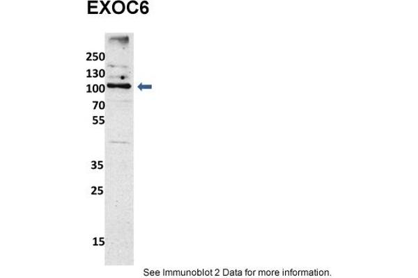 EXOC6 Antikörper  (N-Term)