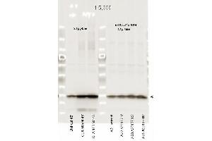 Immunoblotting. (MYL12A Antikörper  (pSer19, pSer20))