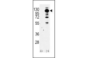 Western blot analysis of PI3KCG Antibody (Center) Pab (ABIN392817 and ABIN2842248) (arrow) using purified Pab. (PIK3 gamma Antikörper  (AA 518-547))