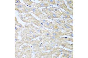 Immunohistochemistry of paraffin-embedded human liver using NUDT15 antibody. (NUDT15 Antikörper  (AA 1-164))