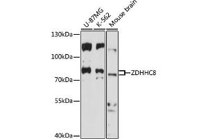 ZDHHC8 Antikörper  (AA 240-380)