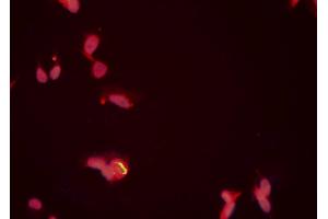 ABIN6276704 staining HeLa cells by ICC/IF. (PRMT5 Antikörper  (Internal Region))