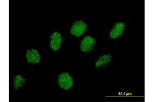 Immunofluorescence of purified MaxPab antibody to PRPF40A on HeLa cell.