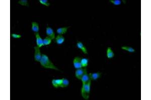 Immunofluorescence staining of SH-SY5Y cells with ABIN7172718 at 1:66, counter-stained with DAPI. (BACH2 Antikörper  (AA 136-235))