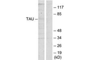 Western blot analysis of extracts from HeLa cells, using Tau (Ab-262) Antibody. (tau Antikörper  (AA 551-600))