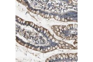Immunohistochemical staining of human small intestine with SCN4B polyclonal antibody  shows moderate positivity in glandular cells.