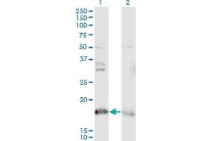 Western Blot analysis of NDUFA8 expression in transfected 293T cell line by NDUFA8 monoclonal antibody (M05), clone 2E10. (NDUFA8 Antikörper  (AA 1-72))