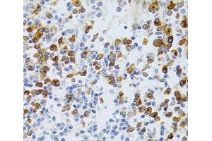 Immunohistochemistry of paraffin-embedded Human tonsil using CHAF1B Polyclonal Antibody at dilution of 1:100 (40x lens). (CHAF1B Antikörper)