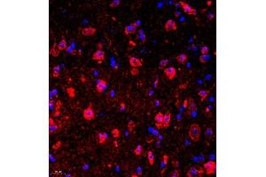 Immunofluorescence of paraffin embedded mouse spinal cord using deltex (ABIN7073794) at dilution of 1:200 (400x lens) (Deltex Homolog 1 Antikörper)