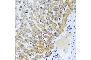 Immunohistochemistry of paraffin-embedded human liver using CPA6 antibody (ABIN6291611) at dilution of 1:100 (40x lens).