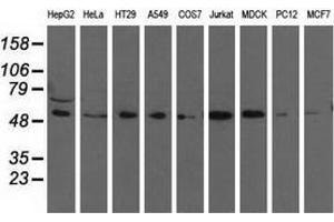 Western blot analysis of extracts (35 µg) from 9 different cell lines by using anti-TCP11L2 monoclonal antibody. (TCP11L2 Antikörper)