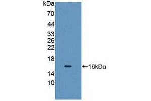 Detection of Recombinant CYP11A1, Human using Polyclonal Antibody to Cytochrome P450 11A1 (CYP11A1) (CYP11A1 Antikörper  (AA 392-521))