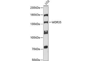 Western blot analysis of extracts of LO2 cells, using WDR35 antibody (ABIN6132986, ABIN6150192, ABIN6150193 and ABIN6216589) at 1:3000 dilution. (WDR35 Antikörper  (AA 871-1170))