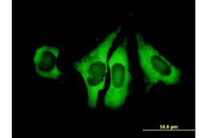 Immunofluorescence of purified MaxPab antibody to EIF4G1 on HeLa cell. (EIF4G1 Antikörper  (AA 1-645))