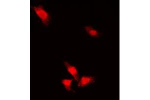 Immunofluorescent analysis of AKT (pS473) staining in MCF7 cells. (AKT1 Antikörper  (C-Term, pSer473))