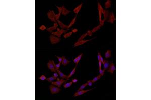 Immunofluorescence (IF) image for anti-Docking Protein 4 (DOK4) (AA 240-326) antibody (ABIN3020722)