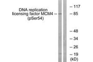 Western blot analysis of extracts from COS7 cells treated with nocodazole 1ug/ml 16h, using MCM4 (Phospho-Ser54) Antibody. (MCM4 Antikörper  (pSer54))