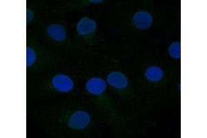 FZD10 Antibody    Sample type:  COS7 cells mock transfected   Primary Ab dilution:  1:333   Secondary Ab:  anti-rabbit-Cy2   Secondary Ab dilution:  1:500   Blue:  DAPI   Green: FZD10   Data submitted by:  Lisa Galli/Laura Burrus  San Francisco State University