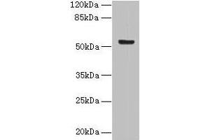Western blot All lanes: DENND2D antibody at 4 μg/mL + MCF-7 whole cell lysate Secondary Goat polyclonal to rabbit IgG at 1/10000 dilution Predicted band size: 54 kDa Observed band size: 54 kDa (DENND2D Antikörper  (AA 1-233))