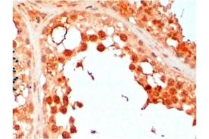 Paraffin Embedded Human Testis stained with UBE2R2 antibody at 2 μg/ml. (UBE2R2 Antikörper  (N-Term))