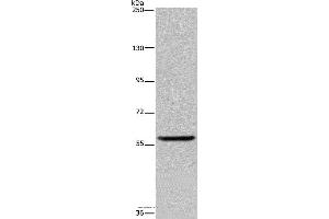 Western blot analysis of Human fetal brain tissue, using LBR Polyclonal Antibody at dilution of 1:300
