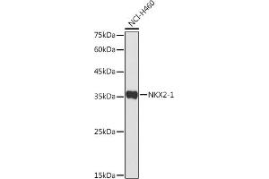 Western blot analysis of extracts of NCI-H460 cells, using NKX2-1 antibody (ABIN3017367, ABIN3017368, ABIN1681058 and ABIN6220056) at 1:500 dilution. (NKX2-1 Antikörper)