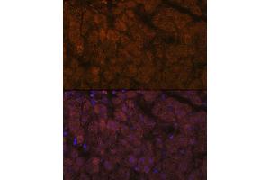Immunofluorescence (IF) image for anti-ADAM Metallopeptidase with Thrombospondin Type 1 Motif, 13 (ADAMTS13) antibody (ABIN7265440)