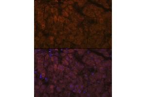 Immunofluorescence analysis of human liver using  Rabbit mAb (ABIN7265440) at dilution of 1:100 (40x lens). (ADAMTS13 Antikörper)