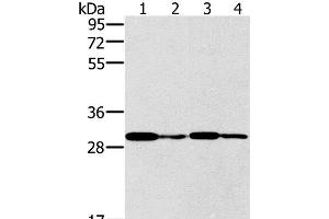 Western Blot analysis of K562 cell and Human liver cancer tissue, Jurkat and A549 cell using PNMT Polyclonal Antibody at dilution of 1:400 (PNMT Antikörper)