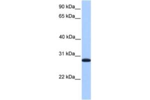Western Blotting (WB) image for anti-Cyclin-Dependent Kinase Inhibitor 3 (CDKN3) antibody (ABIN2463585) (CDKN3 Antikörper)