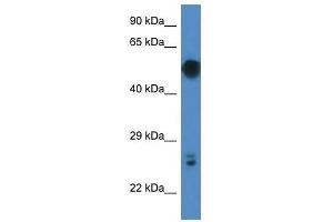 Western Blot showing Gal3st4 antibody used at a concentration of 1.