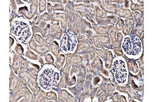 IHC analysis of Integrin Linked ILK using anti-Integrin Linked ILK antibody (ABIN7599411). (ILK Antikörper  (AA 1-452))