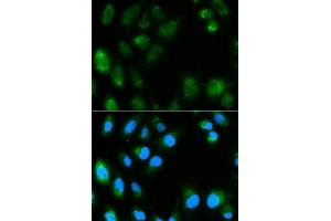 Immunofluorescence analysis of MCF7 cell using UCP3 antibody. (UCP3 Antikörper  (AA 1-110))