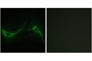 Immunofluorescence analysis of NIH-3T3 cells, using ADCY7 Antibody. (ADCY7 Antikörper  (AA 191-240))