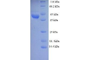 SDS-PAGE (SDS) image for Lactate Dehydrogenase D (LDHD) (AA 1-331), (full length) protein (His tag) (ABIN5713182) (LDHD Protein (AA 1-331, full length) (His tag))