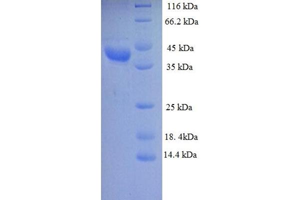 LDHD Protein (AA 1-331, full length) (His tag)