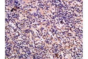 Formalin-fixed and paraffin embedded rat spleen labeled with Anti-GRB10/14 Polyclonal Antibody, Unconjugated  at 1:300 followed by conjugation to the secondary antibody and DAB staining. (GRB10/14 (AA 501-594) Antikörper)