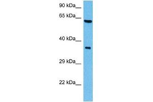 Host:  Mouse  Target Name:  SHC1  Sample Tissue:  Mouse Brain  Antibody Dilution:  1ug/ml (SHC1 Antikörper  (C-Term))
