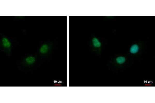 Nth Endonuclease III-Like 1 (NTHL1) (Center) Antikörper