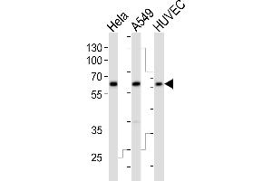 Western blot analysis of lysates from Hela, A549, HUVEC cell line (from left to right), using ESRRG Antibody (Center) (ABIN392350 and ABIN2841989). (ESRRG Antikörper  (AA 189-221))